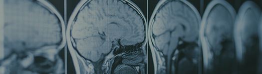 Catastrophic Injuries